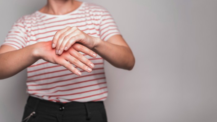 How to Get Rid of Arthritis in Fingers